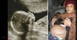 O femeie a fost însărcinată timp de 60 de ani. Cum arăta PRUNCUL când, în sfârşit, l-au adus pe lume? 