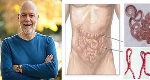 Un medic renumit ne învaţă cum să scăpăm de PARAZIŢII intestinali!