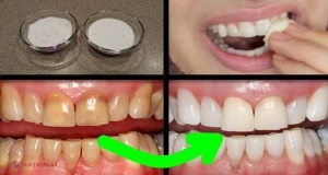 Cum să-ţi albeşti dinţii în mai puţin de două minute – EFECTELE sunt garantate!