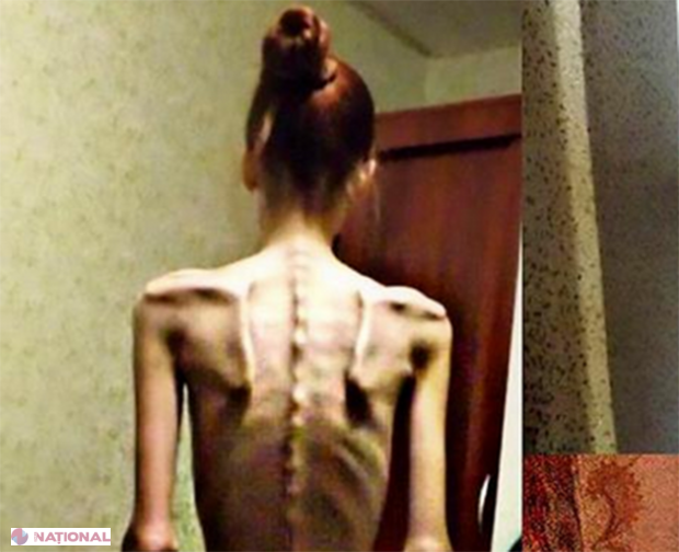 FOTO // Cazul incredibil al unei tinere de 18 ani. În 2014, era anorexică şi cântărea DOAR 32 de kilograme! Acum, este antrenoare de fitness şi arată uimitor