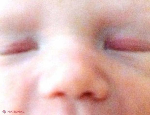 FOTO // Medicii, ULUIȚI după ce au văzut cu ce s-a născut acest bebeluș în gură
