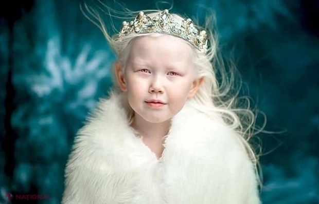 GALERIE FOTO // Alba ca Zăpada există! Povestea fetiţei albinoase pe care se bat AGENŢIILE de modele
