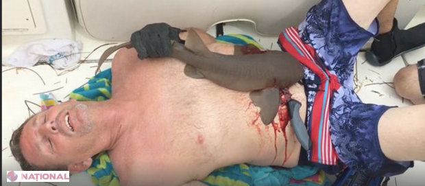 VIDEO // A ieşit din apă cu un rechin înfipt în abdomen!