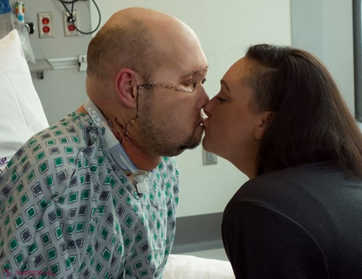 Premieră medicală. Primul transplant total de ochi, efectuat de medici din SUA