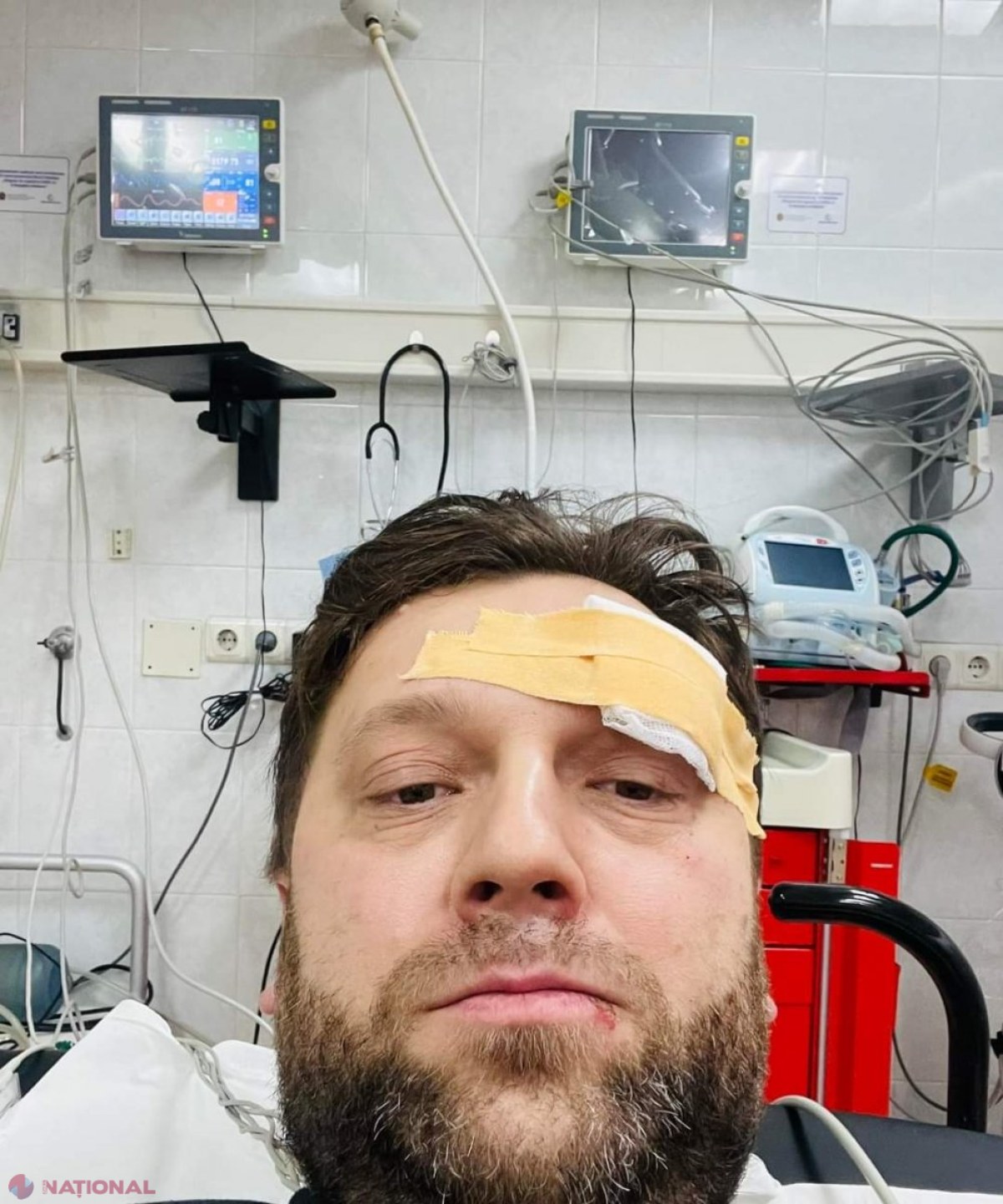 FOTO // Noul ministru al Economiei, victima unui ,,ACCIDENT tâmpit