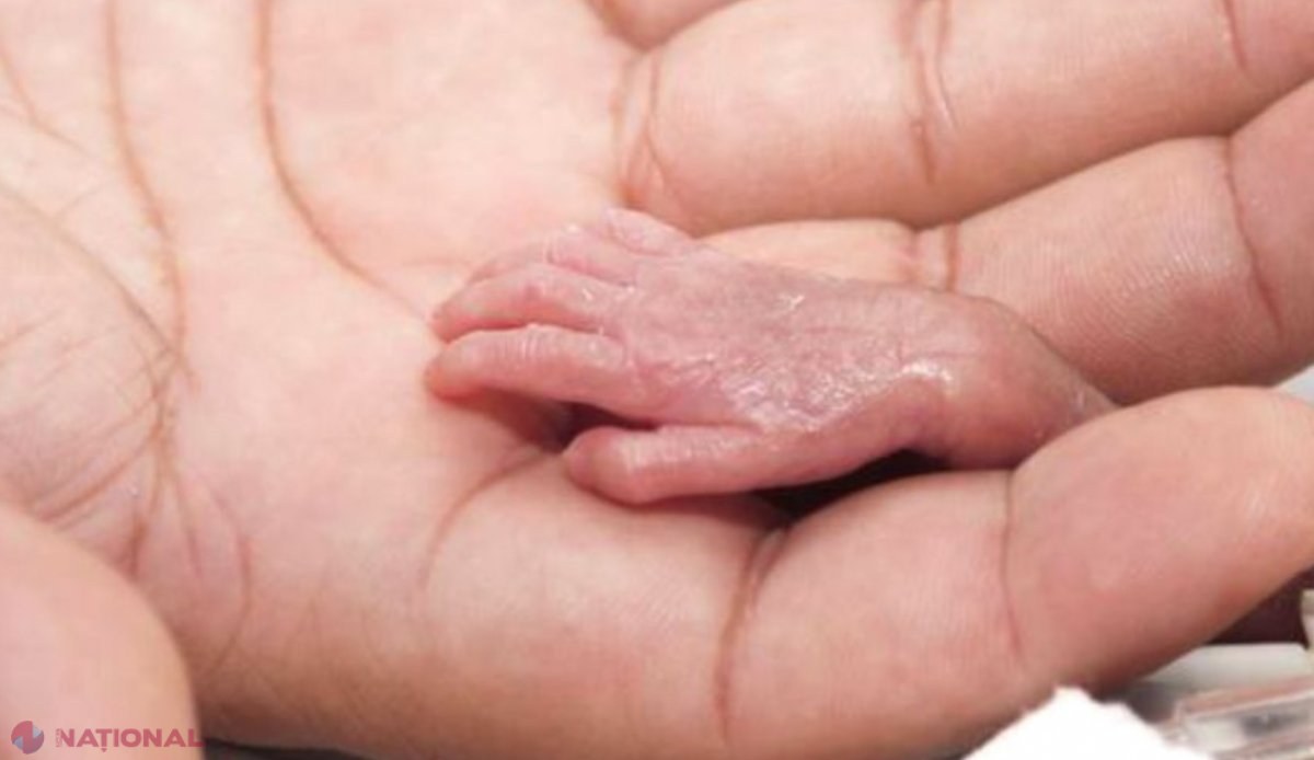 Născută în luna a CINCEA, Lyla e cel mai prematur copil din lume. Cum arată acum, după ce a crescut