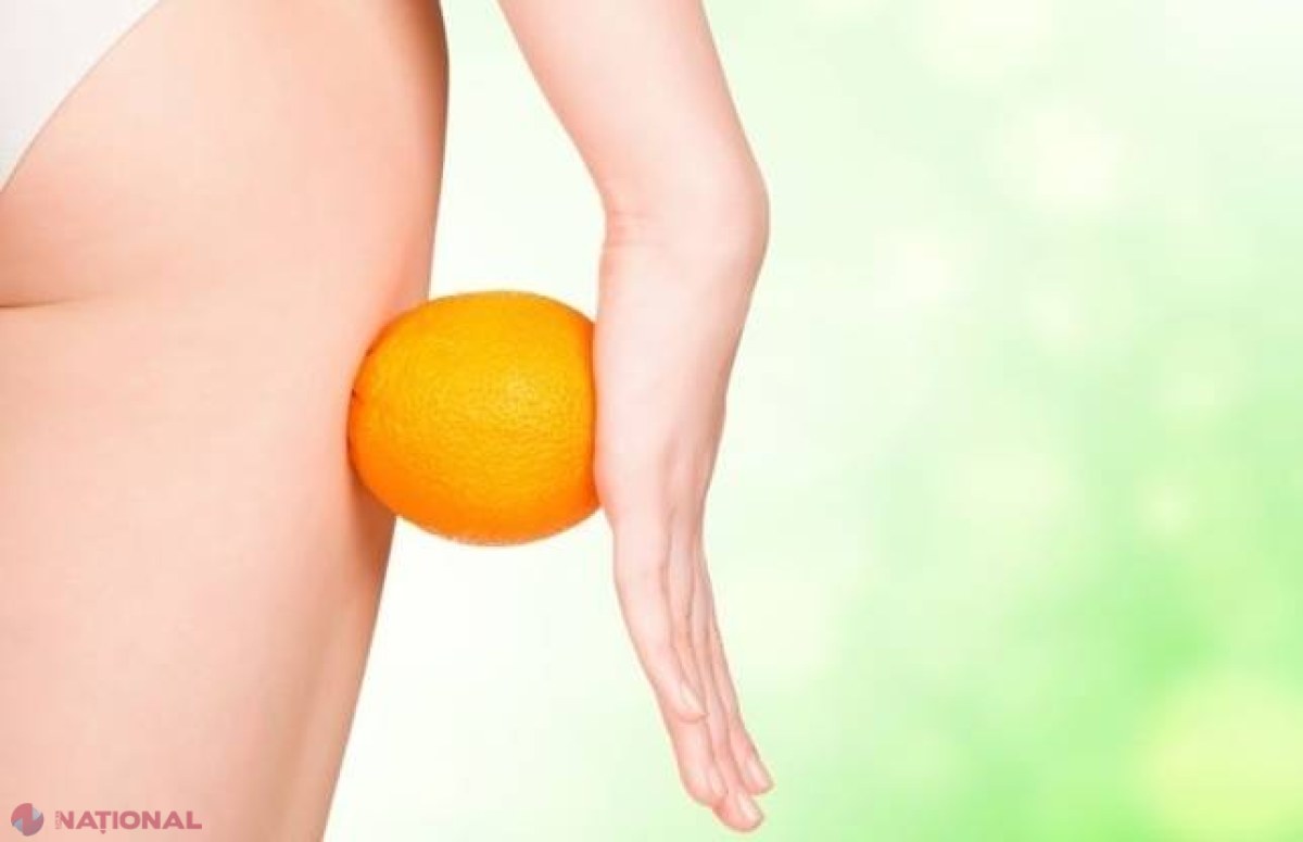 Scapă de CELULITĂ cu acest amestec natural!