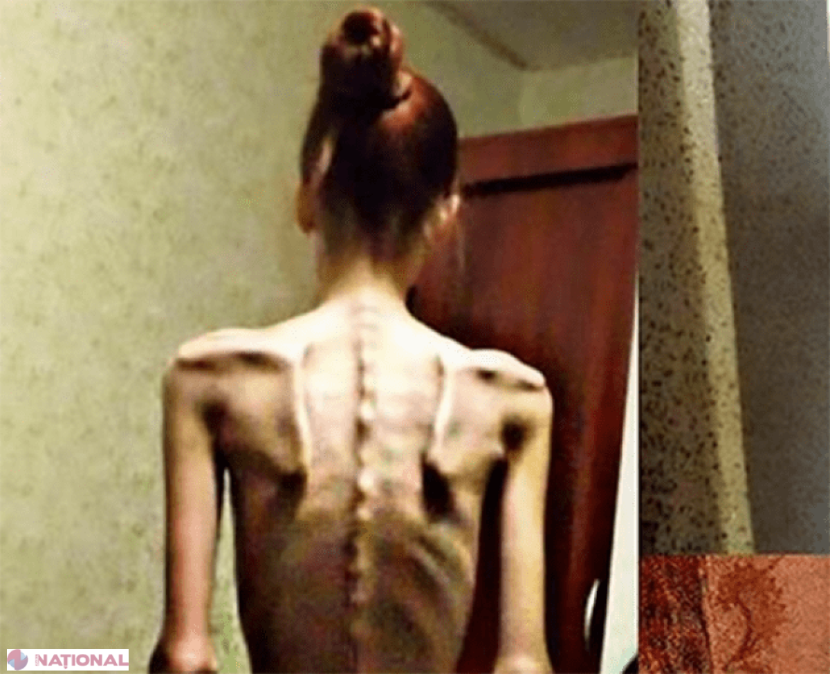FOTO // Cazul incredibil al unei tinere de 18 ani. În 2014, era anorexică şi cântărea DOAR 32 de kilograme! Acum, este antrenoare de fitness şi arată uimitor