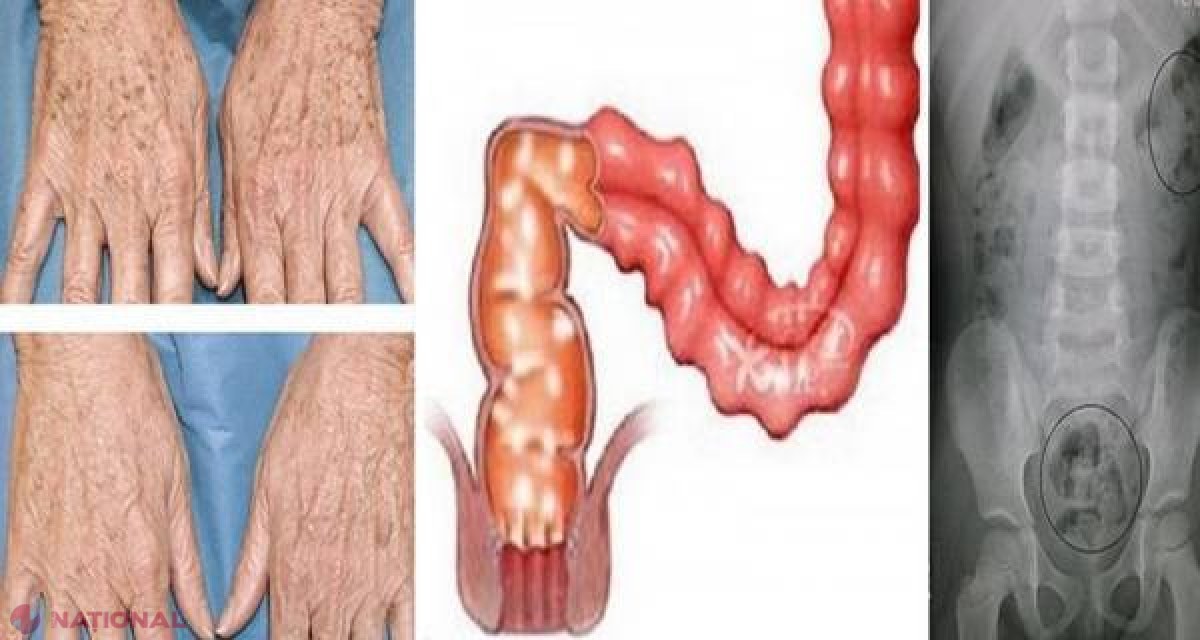 UTIL // Scapă de petele de bătrâneţe, constipaţie, dureri articulare, musculare… cu un singur PRODUS natural!