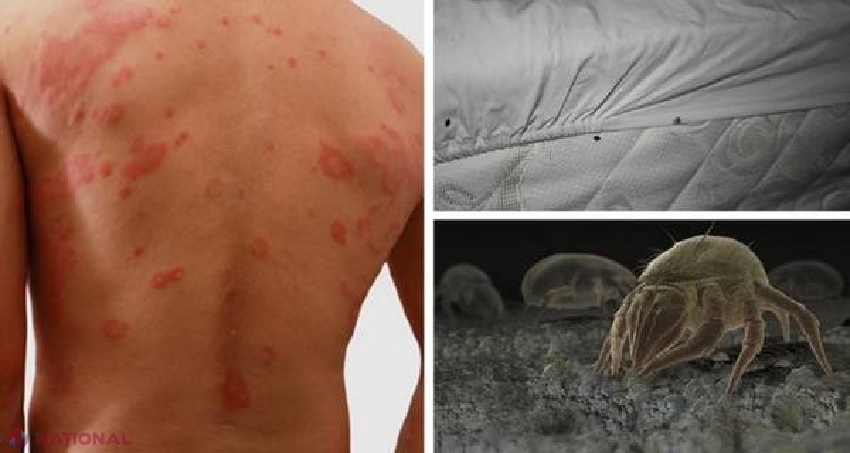 ACARIENII din aşternuturi provoacă îmbolnăviri – scapă de ei cu această soluţie simplă! 