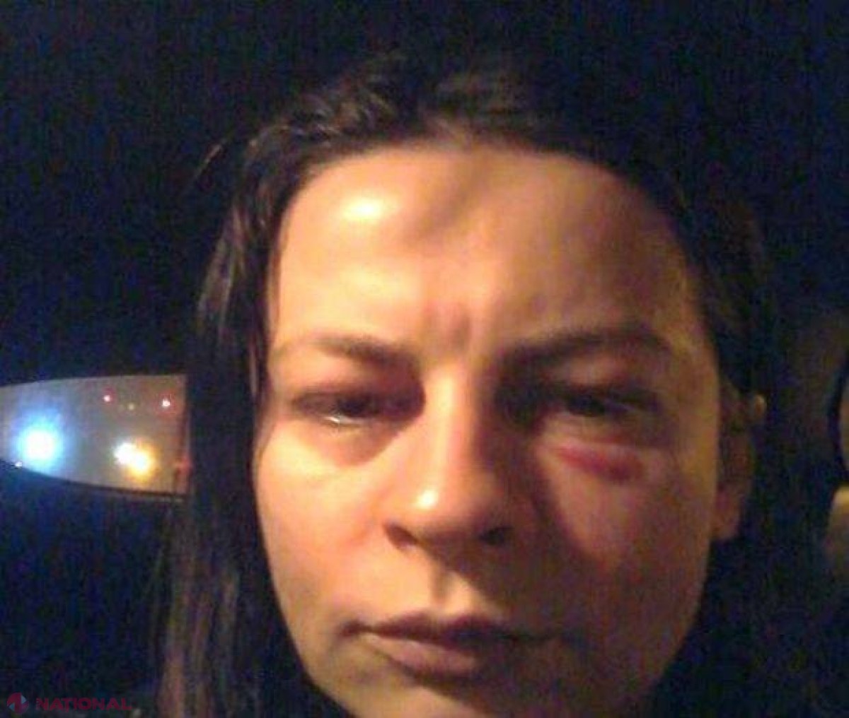 Când viaţa în familie se TRANSFORMĂ într-un meci de box. Imagine şocantă publicată de soţia unui politician 