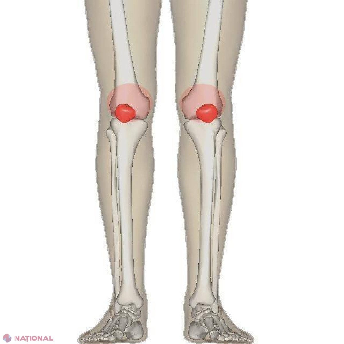 Medicii sunt UIMIȚI. Acest tratament natural COMBATE DURERILE articulare și previne osteoporoza