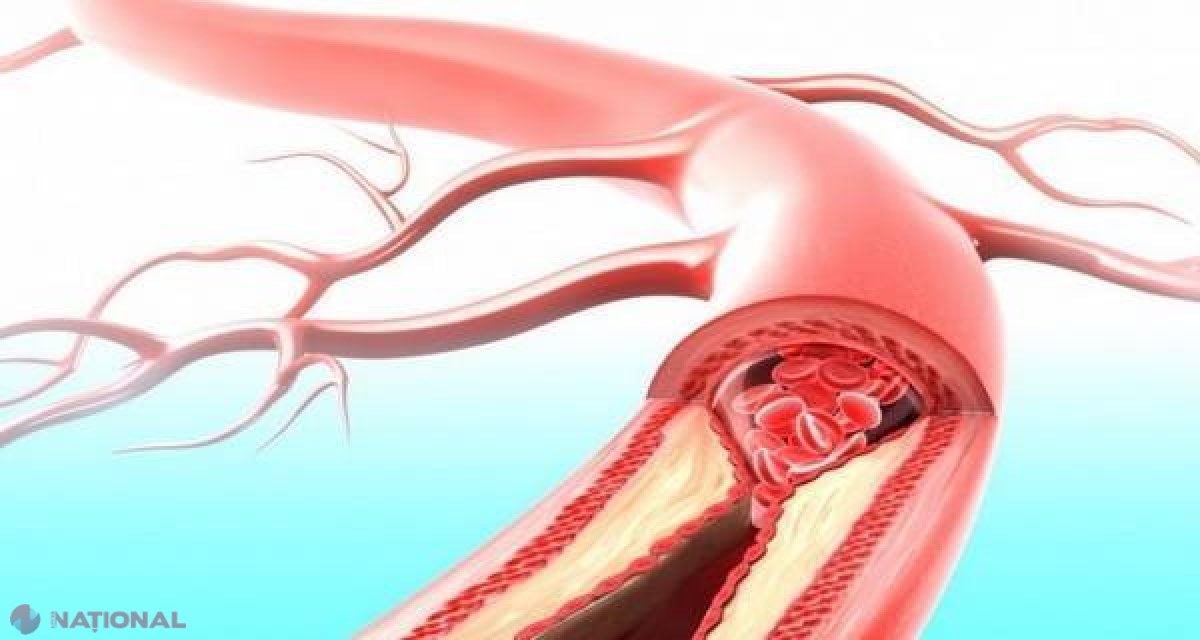 DIETĂ // Băutura plină „de sănătate”! Te ajută să elimini toxinele și să slăbești