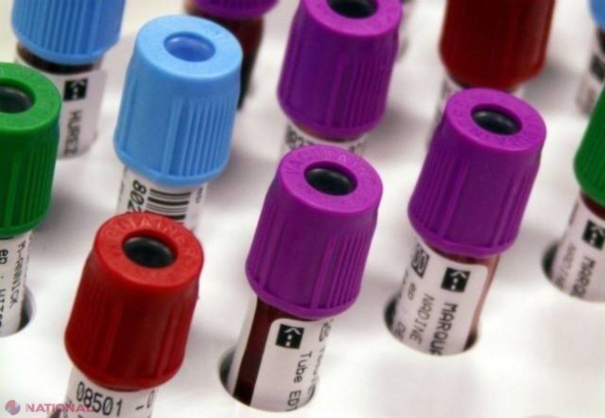 INVENȚIE // Cancerul ar putea fi detectat printr-un test de sânge