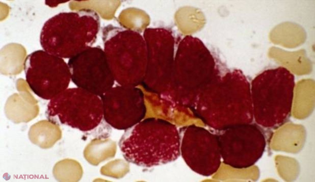Premieră URIAŞĂ! Terapia revoluţionară care a SALVAT pacienţi aflaţi în faza terminală de cancer