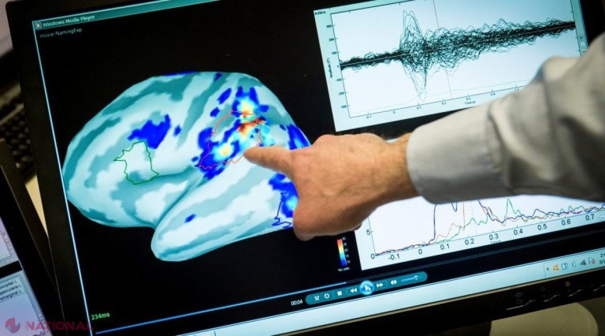 Primul medicament pentru Alzheimer, autorizat în SUA în ultimii 20 de ani. Ce spun medicii despre eficacitatea tratamentului