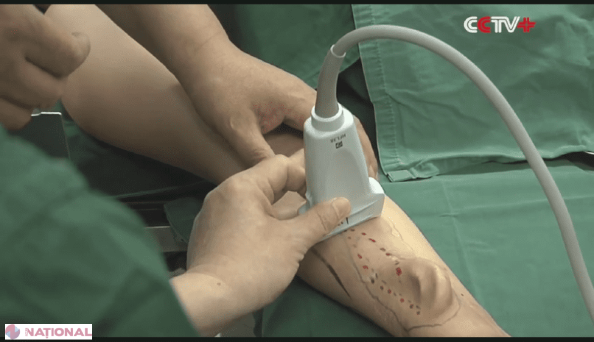 VIDEO // Premieră în lumea medicală: doctorii au transplantat o ureche care a crescut pe antebraţul unui om 