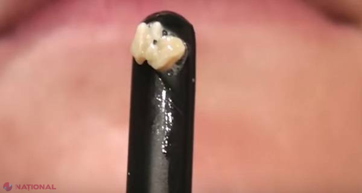 VIDEO // Cauza ascunsă a RESPIRAŢIEI urât mirositoare!