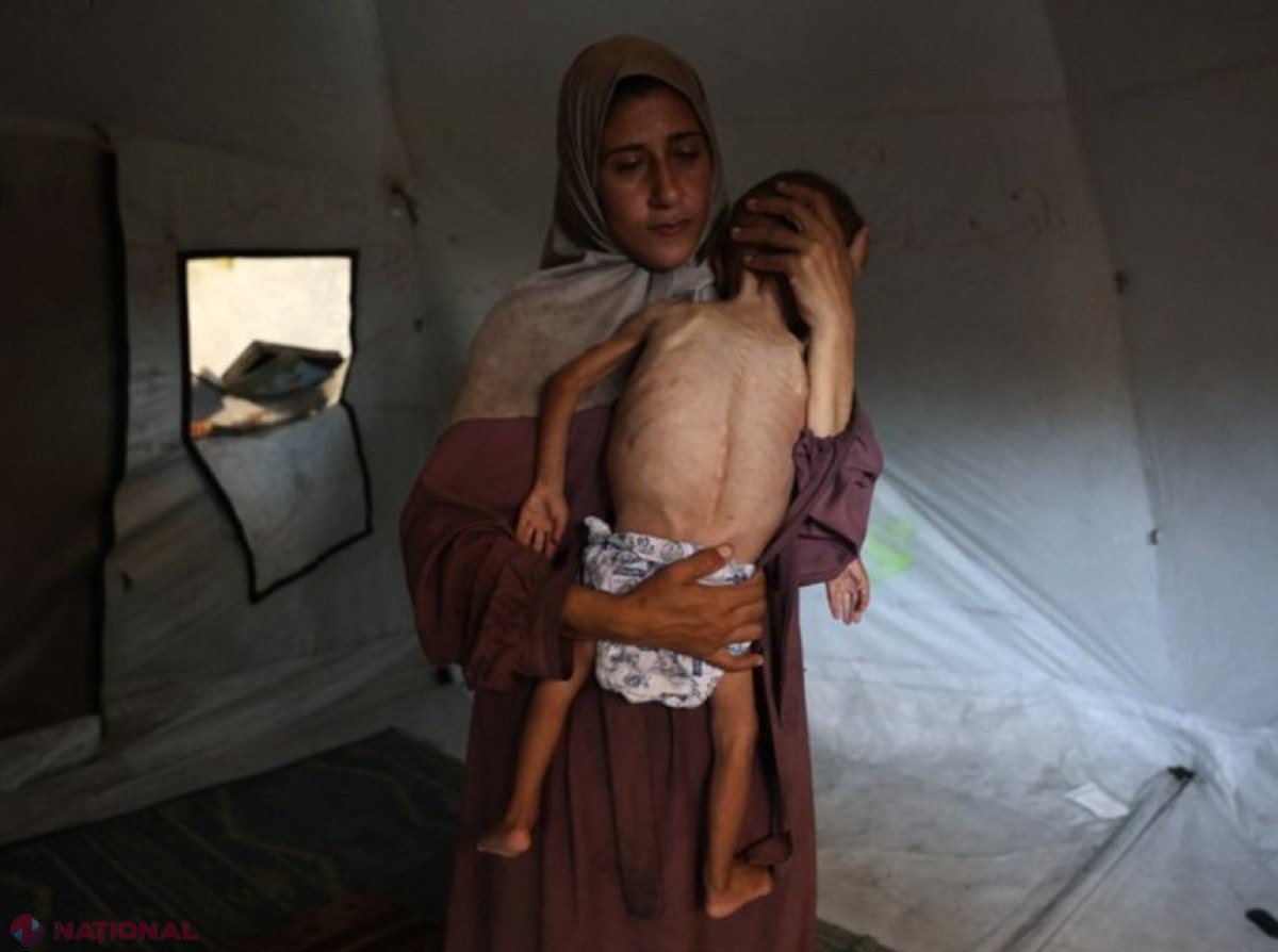 MSF acuză autoritățile israeliene de utilizarea intenționată a foametei ca armă de război în Gaza: un sfert dintre copiii mici și femeile însărcinate suferă de malnutriție.