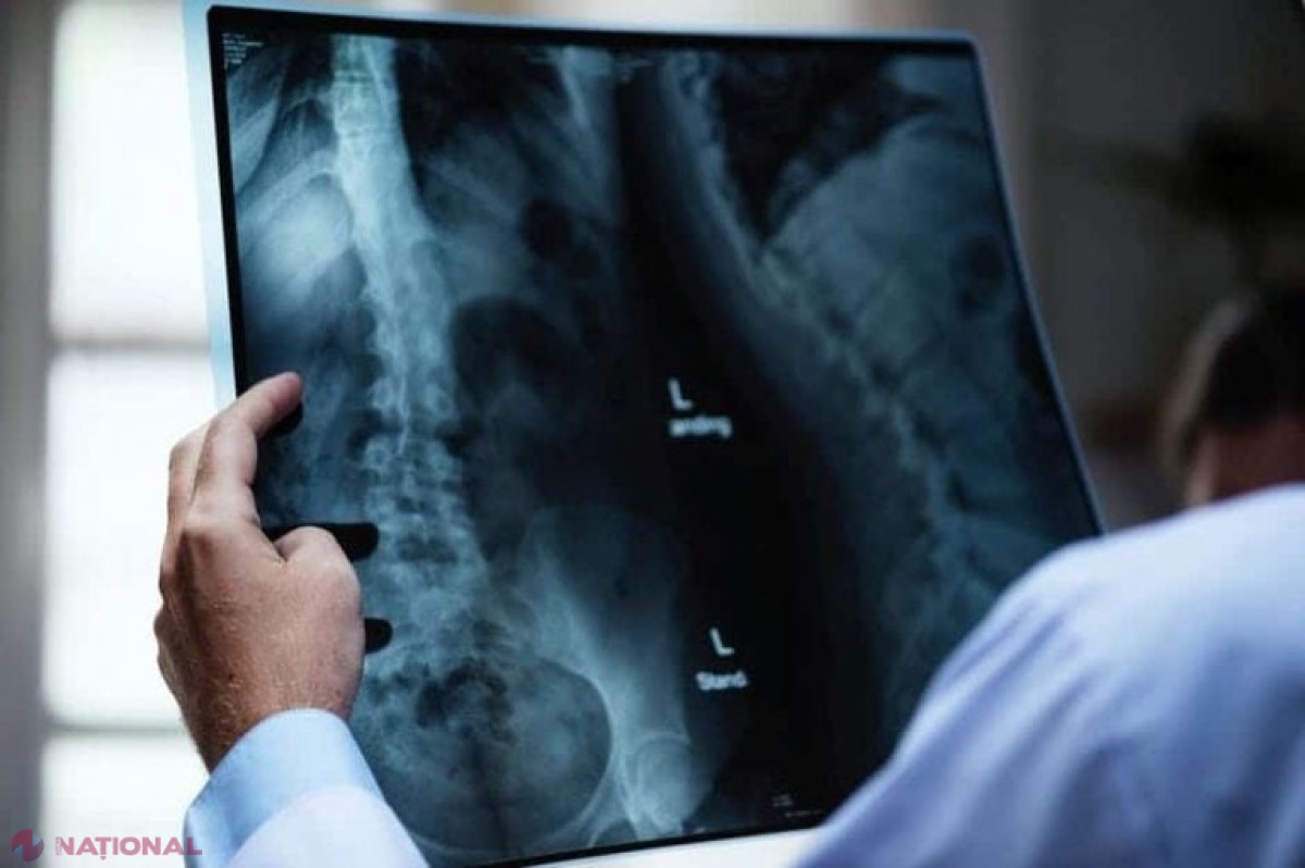 Inovație promițătoare în medicină: radiografiile color de înaltă rezoluție, un pas înainte în depistarea precoce a cancerului și mai mult