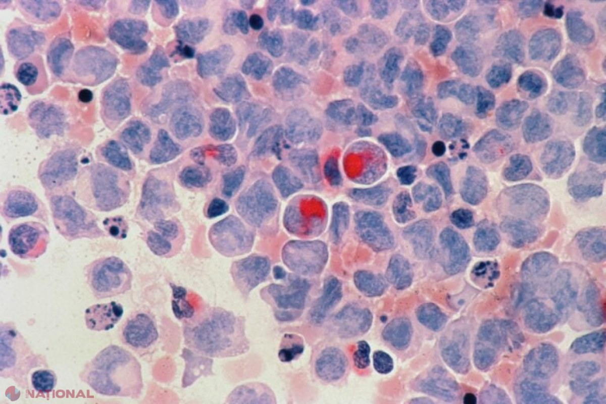 Cercetătorii maghiari dezvoltă un medicament revoluționar împotriva cancerului: teste pe șoareci indică vindecare completă cu o singură doză