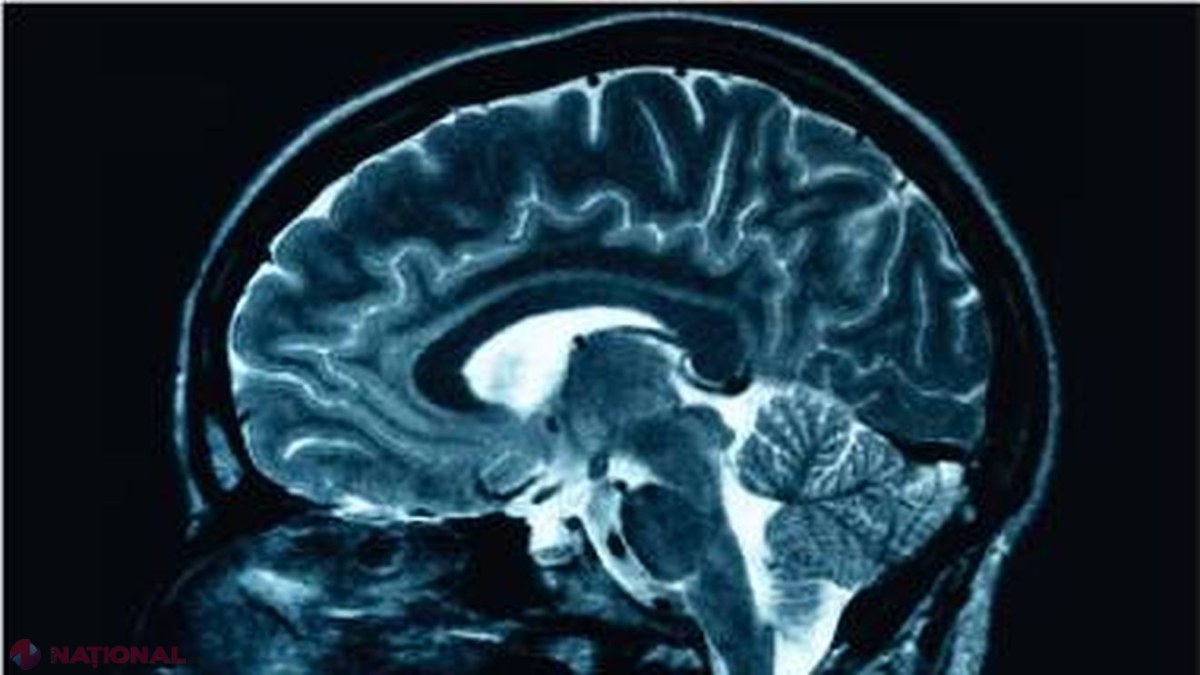 Cum poți depista din timp demența Alzheimer și reduce cu până la jumătate riscul de îmbolnăvire