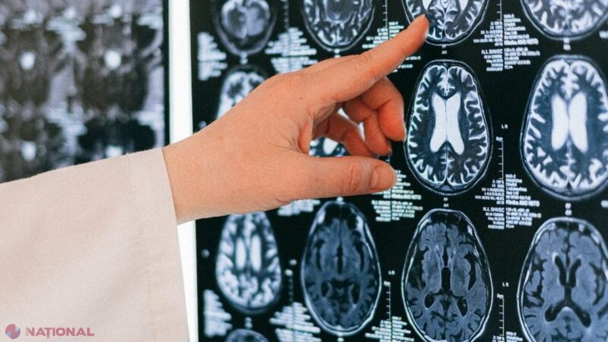 Leziunile la cap pot lăsa urme pe viață în creier și cresc riscul de Parkinson, arată un nou studiu australian