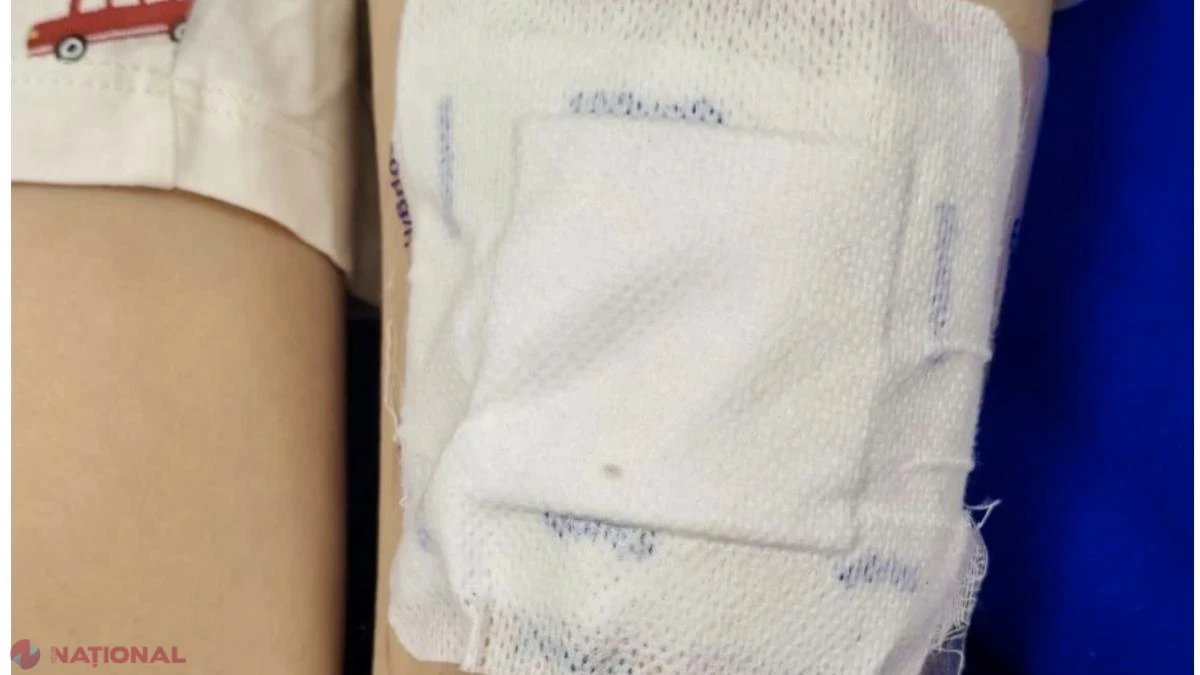 Copil de 6 ani din Botoșani, în comă după plasturi cu fentanil puși pe o rană. Avertismentul medicului Radu Țincu: risc major de stop respirator la supradoză