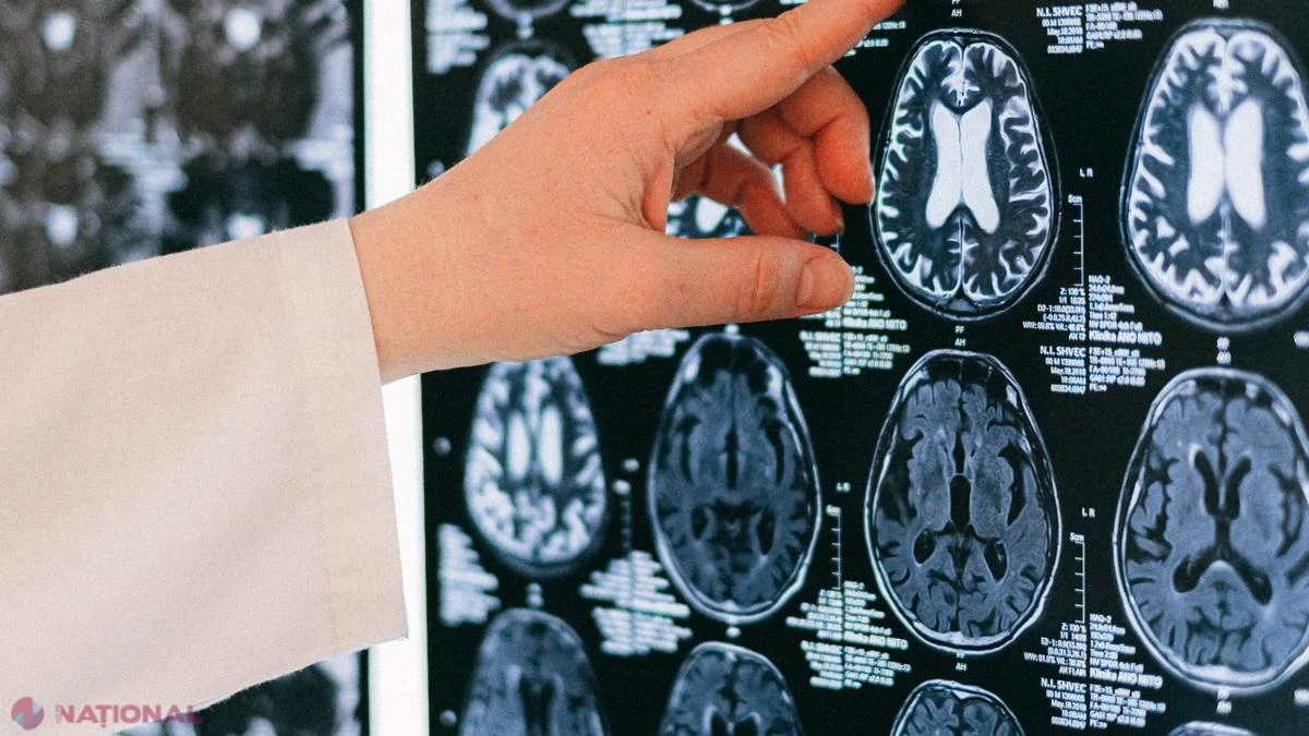 Prof. dr. Dafin Mureșanu: Trei obiceiuri simple care ne ajută să ne menținem creierul sănătosેણ
