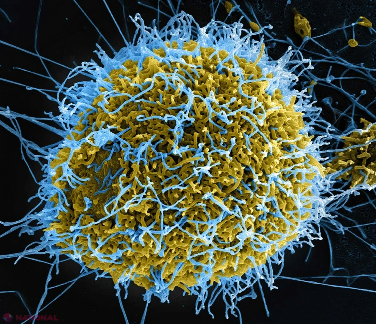 Kenya înregistrează primul deces provocat de virusul Ebola