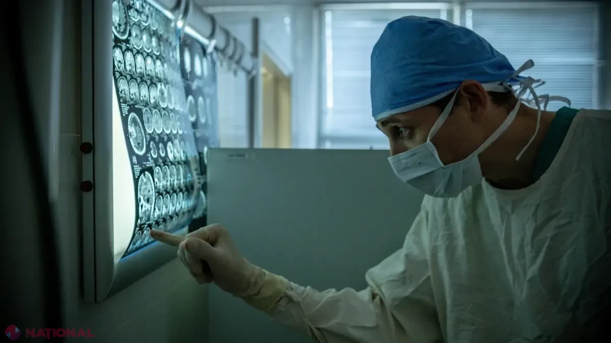 Cum poate RMN-ul de difuzie să ajute pacienții cu AVC când nu se cunoaște ora debutului