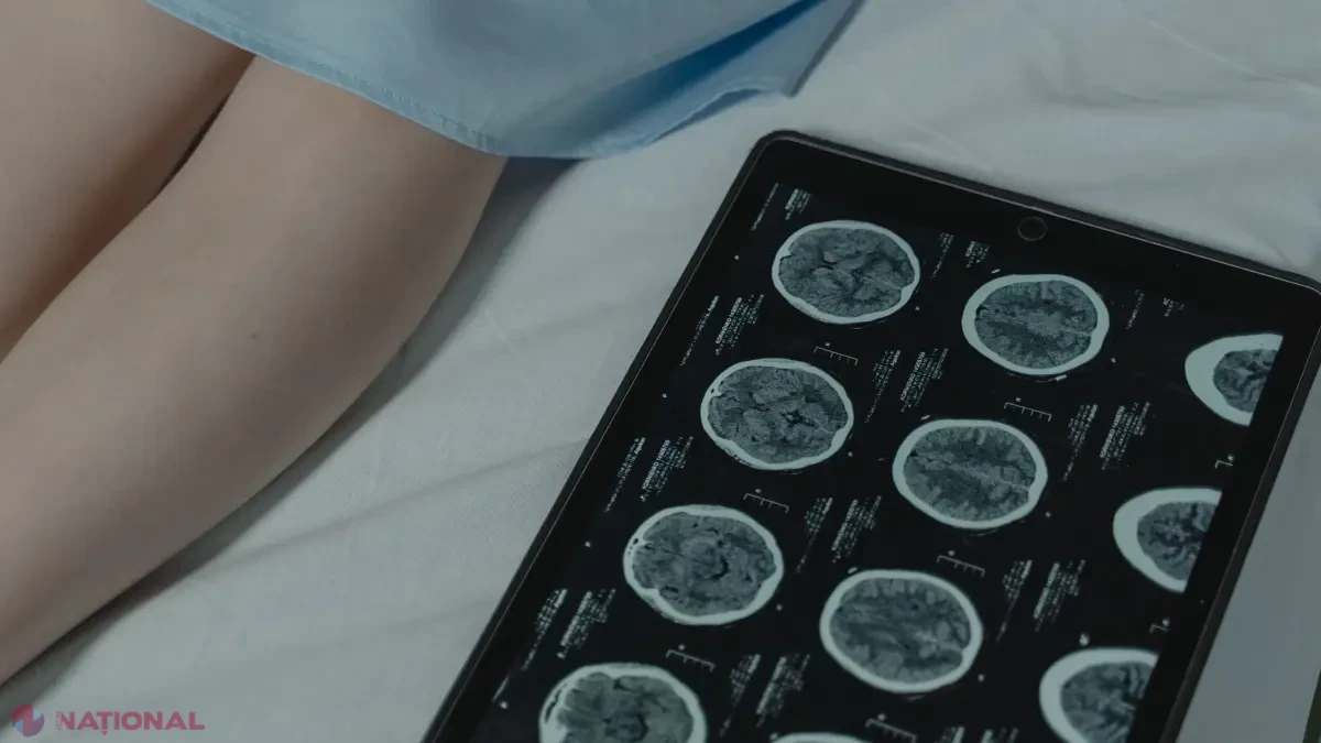 „Nu vreau să fim singuri”: provocările pacienților cu epilepsii rare în România