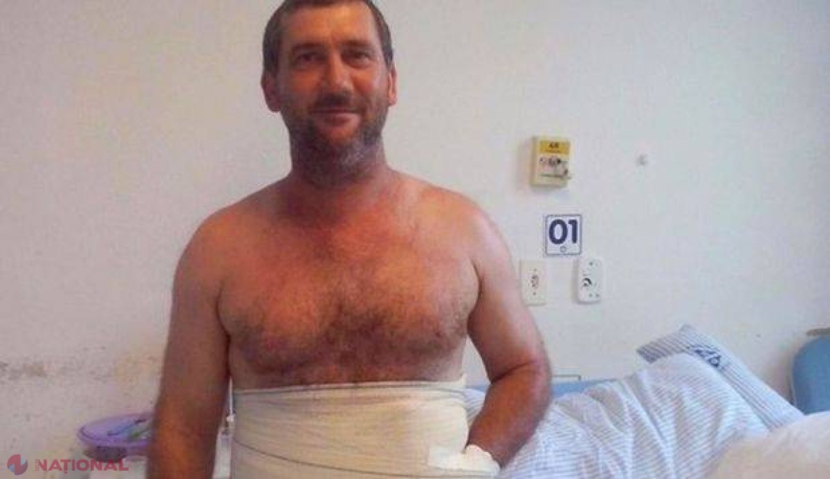 VIDEO, FOTO // Caz CIUDAT în medicină. Un chirurg a cusut mâna unui bărbat în ABDOMEN. Ce s-a întâmplat după bate ştiinţa 
