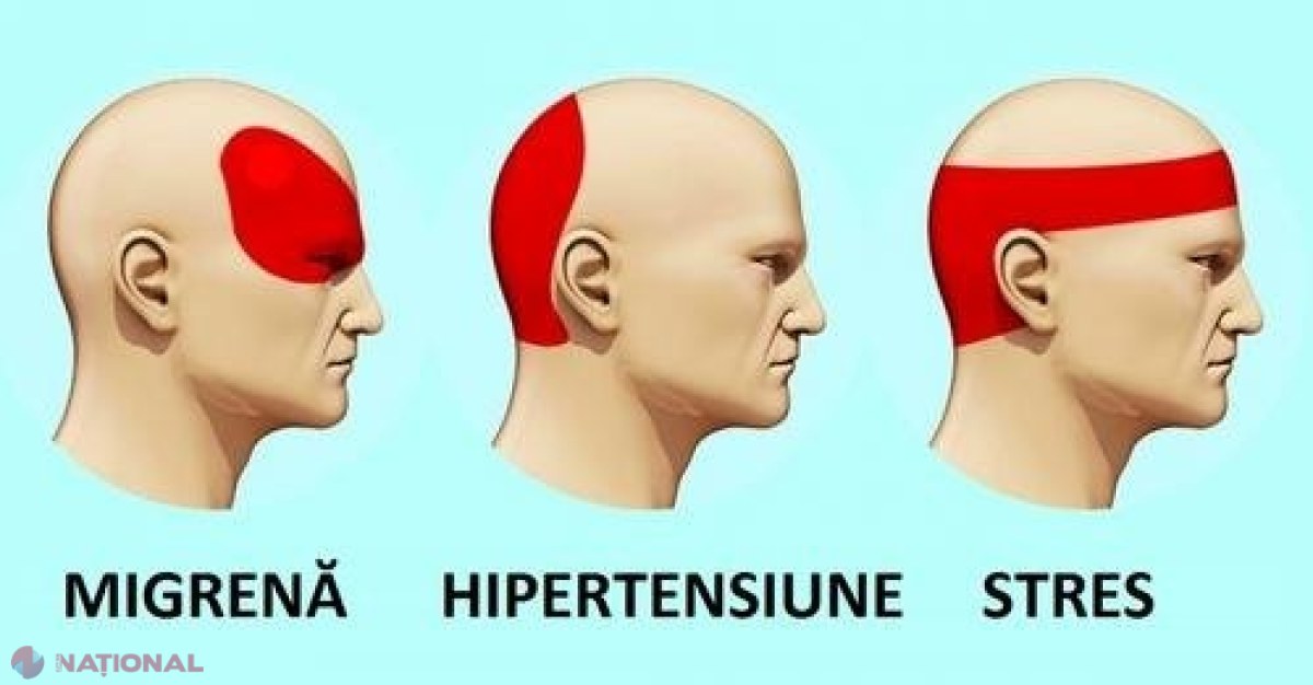 Cum să scapi de DUREREA DE CAP în 5 minute FĂRĂ PASTILE