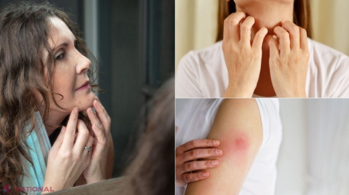 Simptomul STRANIU pe care doar cei infectați cu varianta Omicron îl simt. Ce se întâmplă cu pielea