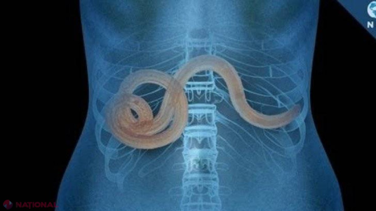 UTIL // Semne clare că ai paraziți în organism