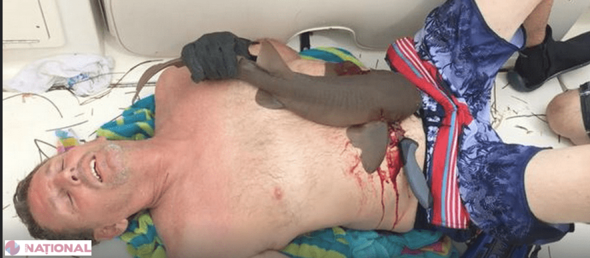 VIDEO // A ieşit din apă cu un rechin înfipt în abdomen!