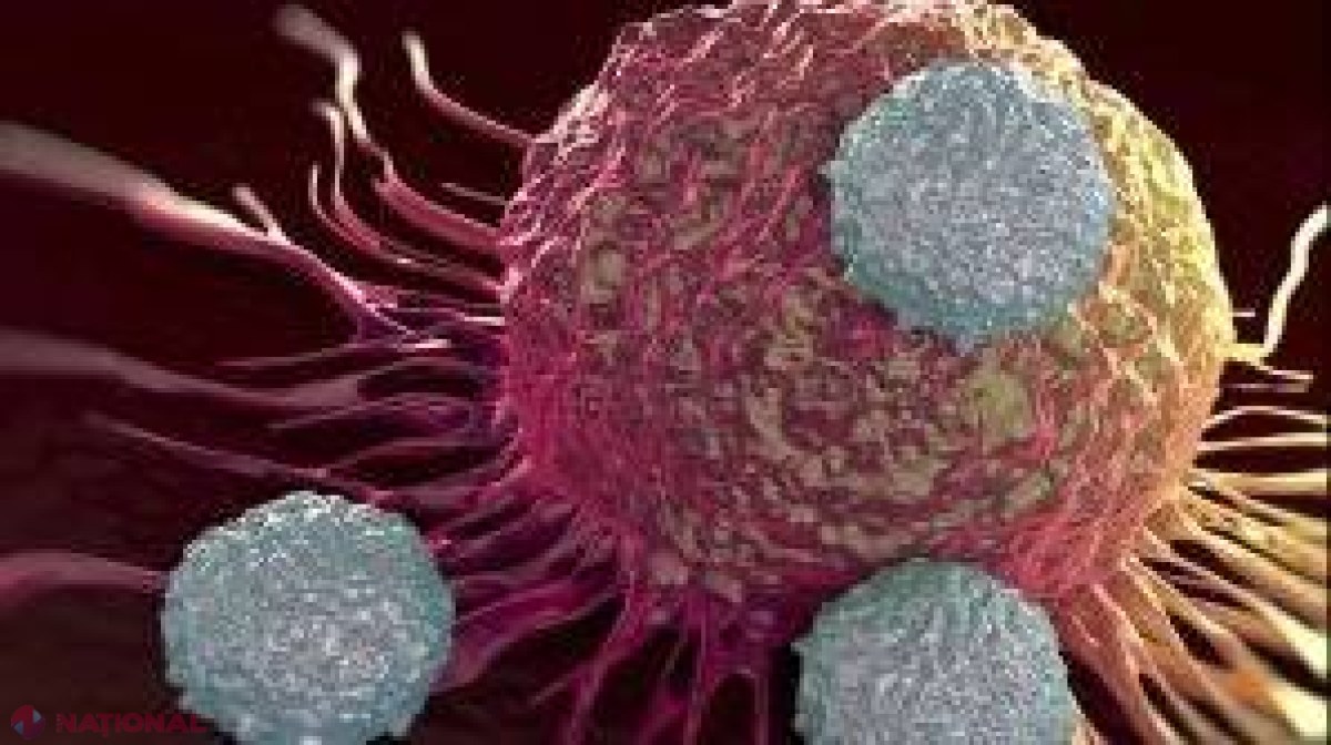 Acesta este alimentul care OMOARĂ celulele canceroase