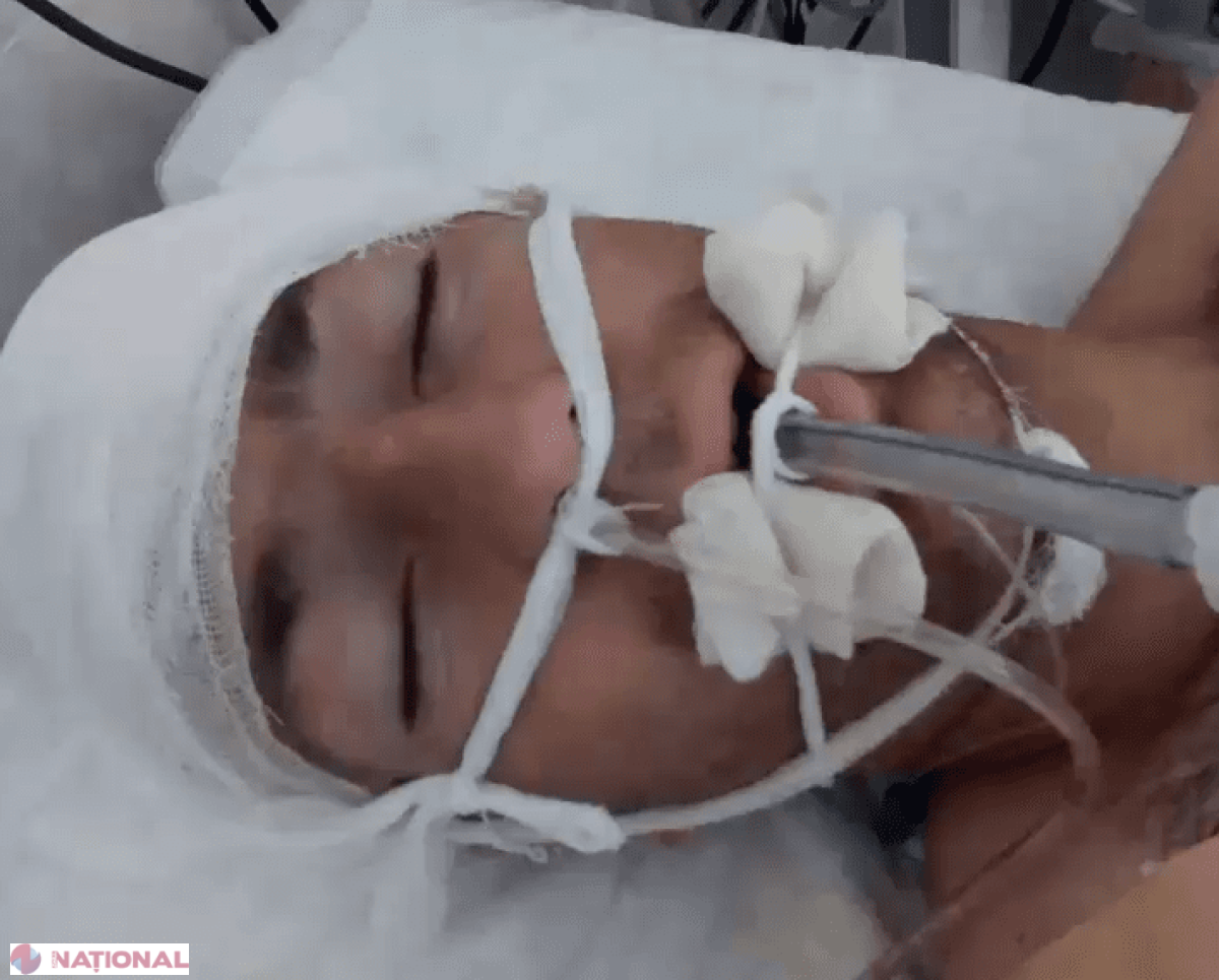 Un tânăr accidentat în Chișinău a decedat la spital peste câteva zile, dar oamenii legii NU știu cine este. Îi poți ajuta?