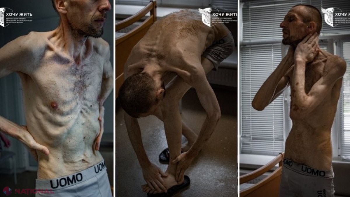 Imagini șocante cu un prizonier ucrainean după doi ani de captivitate în Rusia. „Evocă cele mai întunecate pagini ale istoriei umane” 