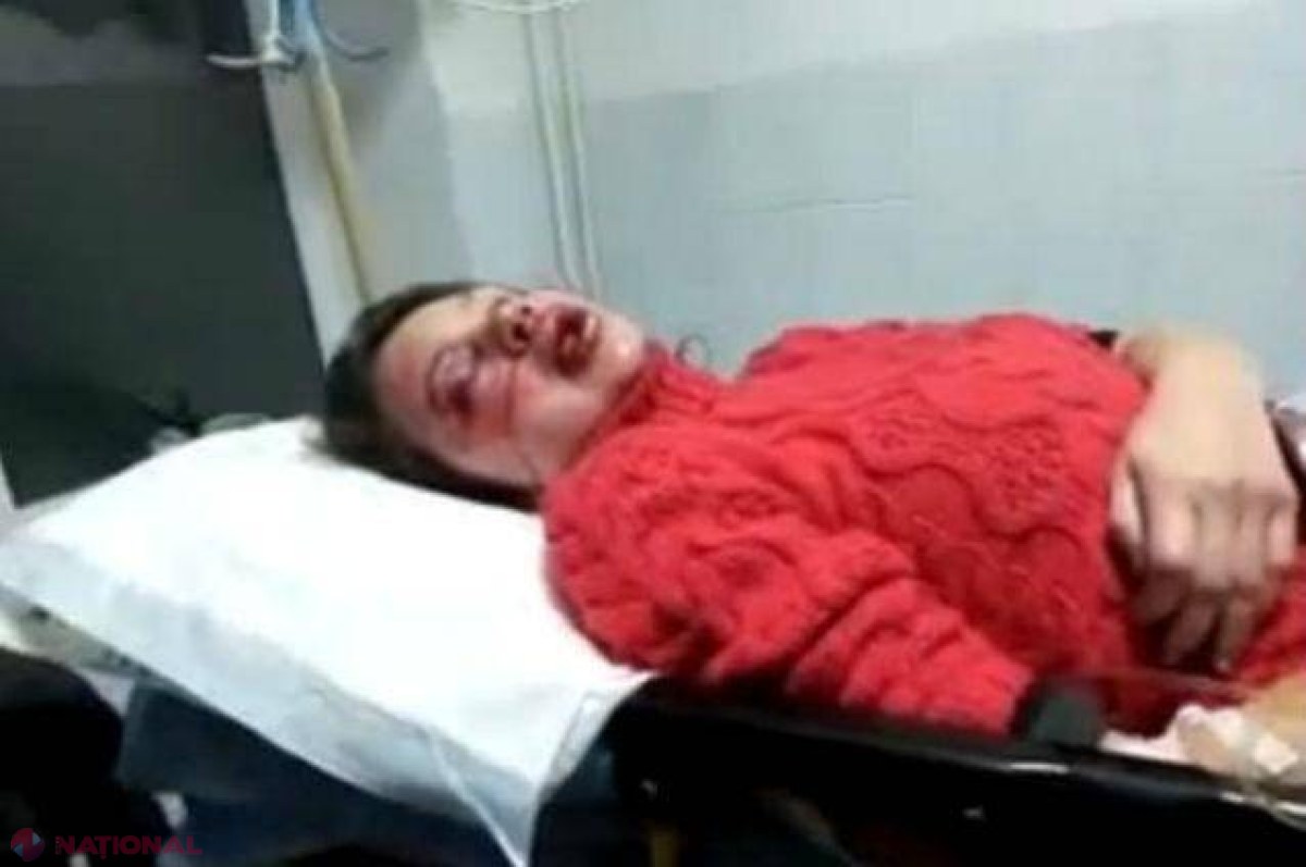 Reacţii dure din SUA şi UE dupa ce o jurnalistă a fost DESFIGURATĂ! 