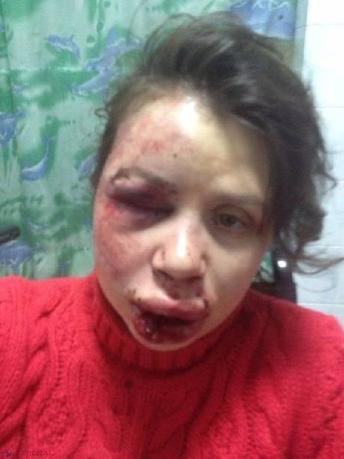 FOTO VIDEO // ȘOCANT! Jurnalistă din UCRAINA, bătută VIOLENT și DESFIGURATĂ la KIEV