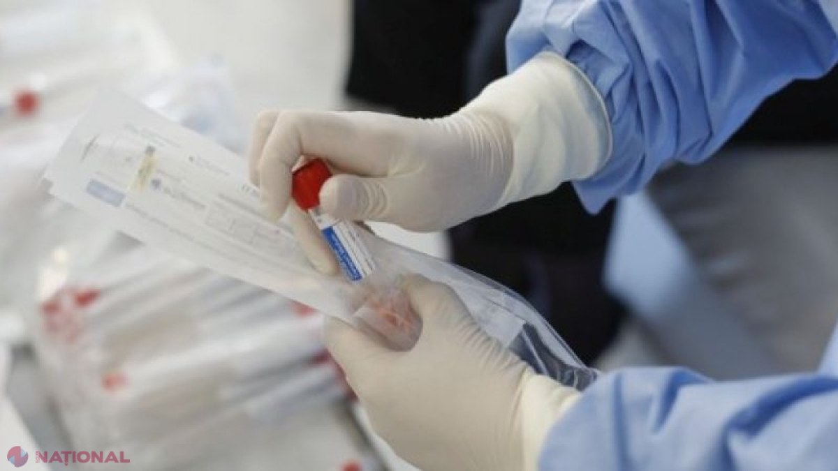 COVID-19: A apărut testul rapid pentru detectarea noului coronavirus, cu o eficiență de 94%