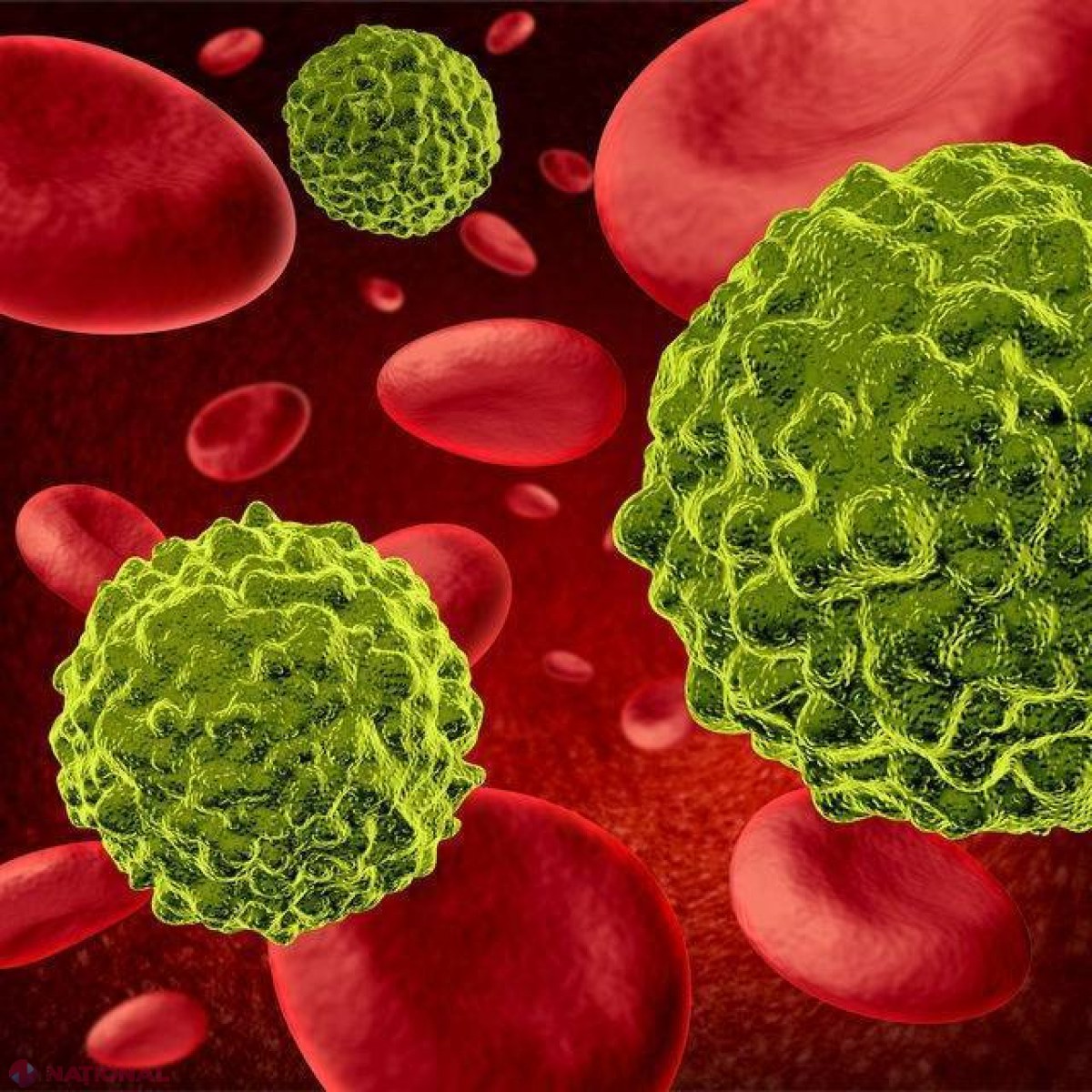 Primele SEMNE de cancer: cum le recunoşti?