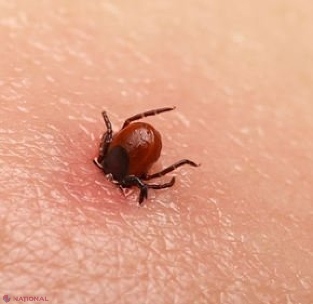 V-a mușcat o căpușă? Un medic dermatolog explică ce trebuie să faceți neapărat