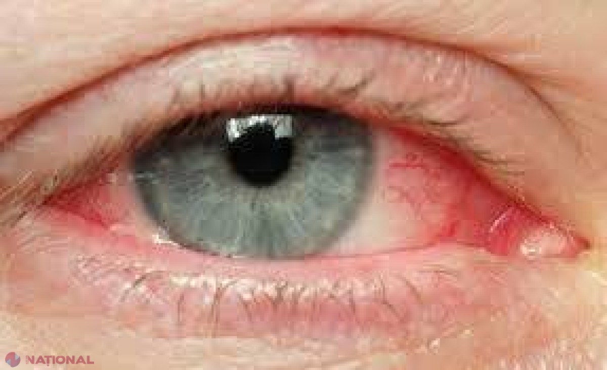 A fost diagnosticat cu CANCER la ochi din cauza obiceiului banal pe care şi tu îl ai zilnic!