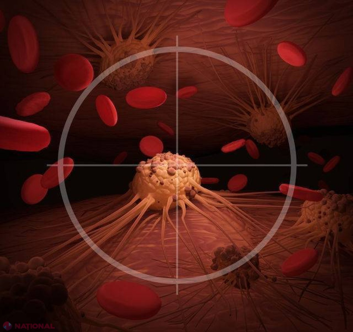 O nouă DESCOPERIRE! S-a inventat plasturele care ucide celulele canceroase