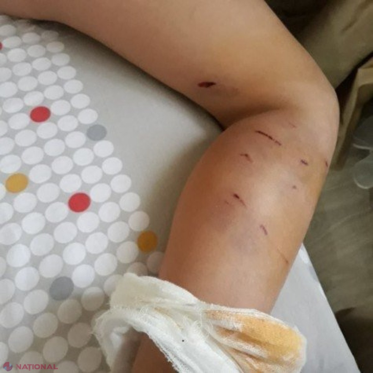 Copil de 7 ani din R. Moldova, atacat de ȘAPTE maidanezi chiar în curtea școlii în care învață: „L-au doborât la pământ, l-au mușcat de picioare și nimeni nu i-a sărit în ajutor”