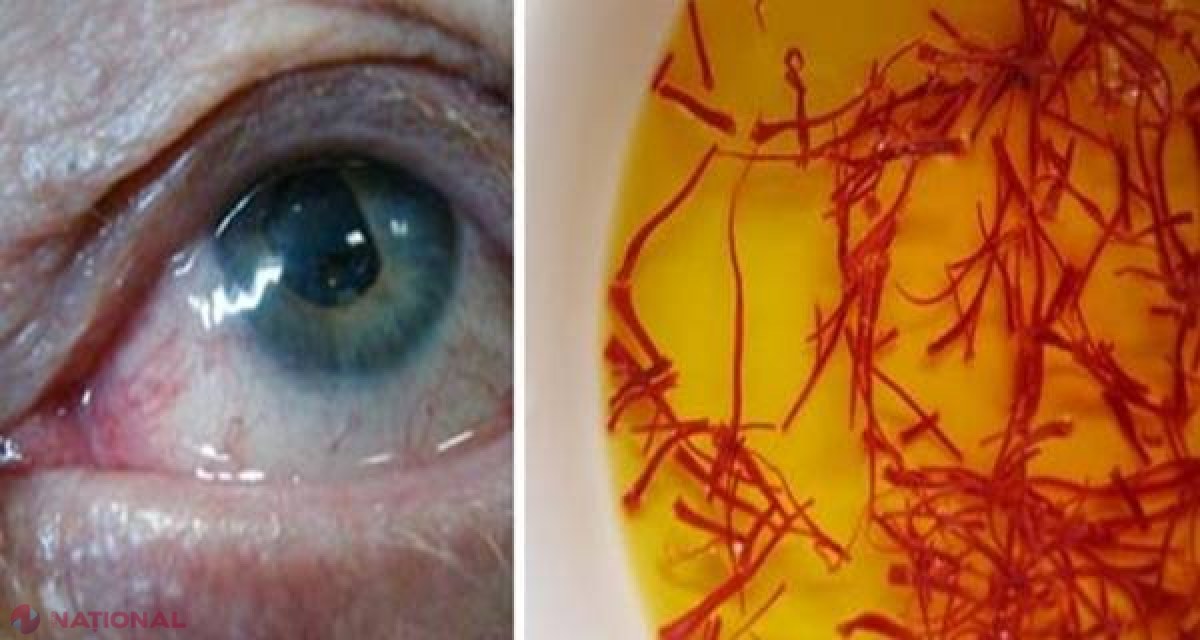 Aruncaţi-va ochelarii! Cu ajutorul acestui ingredient nu veţi mai avea nevoie de ei 
