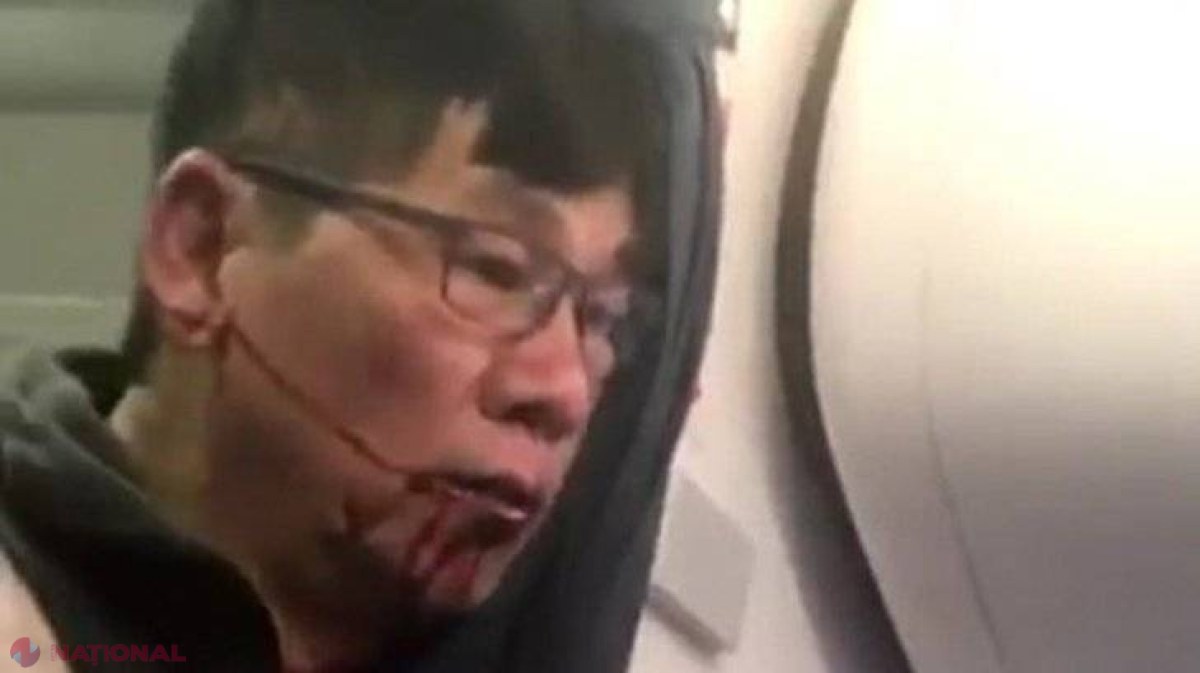 Cine era, de fapt, pasagerul bătut de angajații United Airlines